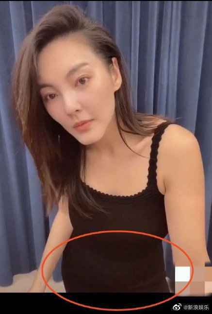 张雨绮肚子明显隆起怎么回事？张雨绮怀孕还是长胖？