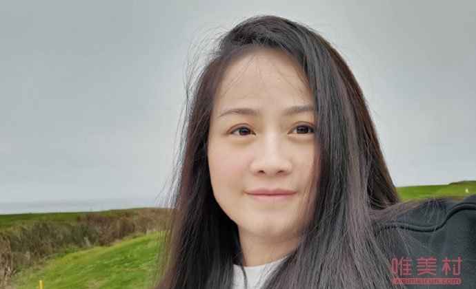 岳云鹏老婆回应生病剃光头说了什么？岳云鹏老婆得了什么病？