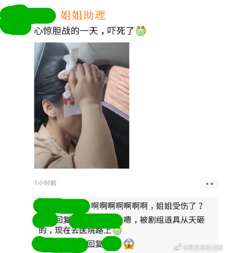 黄圣依拍戏被砸头冒鲜血 黄圣依受伤事件始末