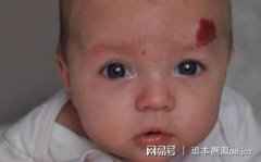 孕期不要做这几件事,为了宝宝的容貌,再喜欢也要忍住