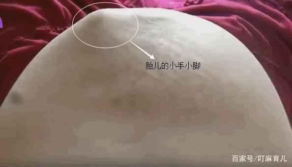 胎儿不停地踹孕妇肚子,是生气了还是不舒服?这3个原因要搞清楚 胎儿不停地踹孕妇肚子,是生气了还是不舒服?这3个原因要搞清楚