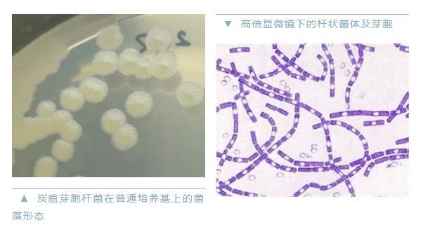  警惕炭疽，和新冠同一等级传染病！如何预防？