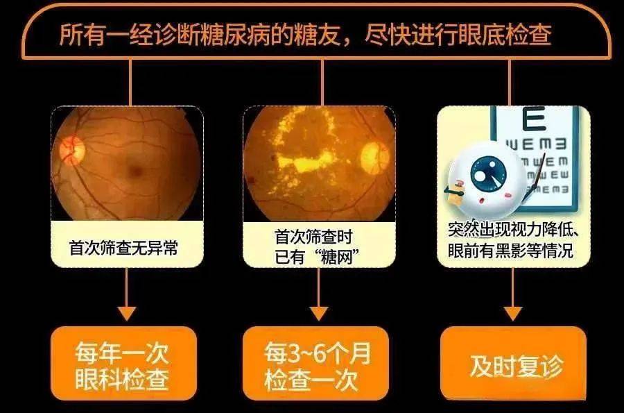 35岁小伙太爱喝饮料致双目失明 一直仗着年轻