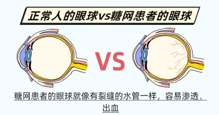 35岁小伙太爱喝饮料致双目失明 一直仗着年轻